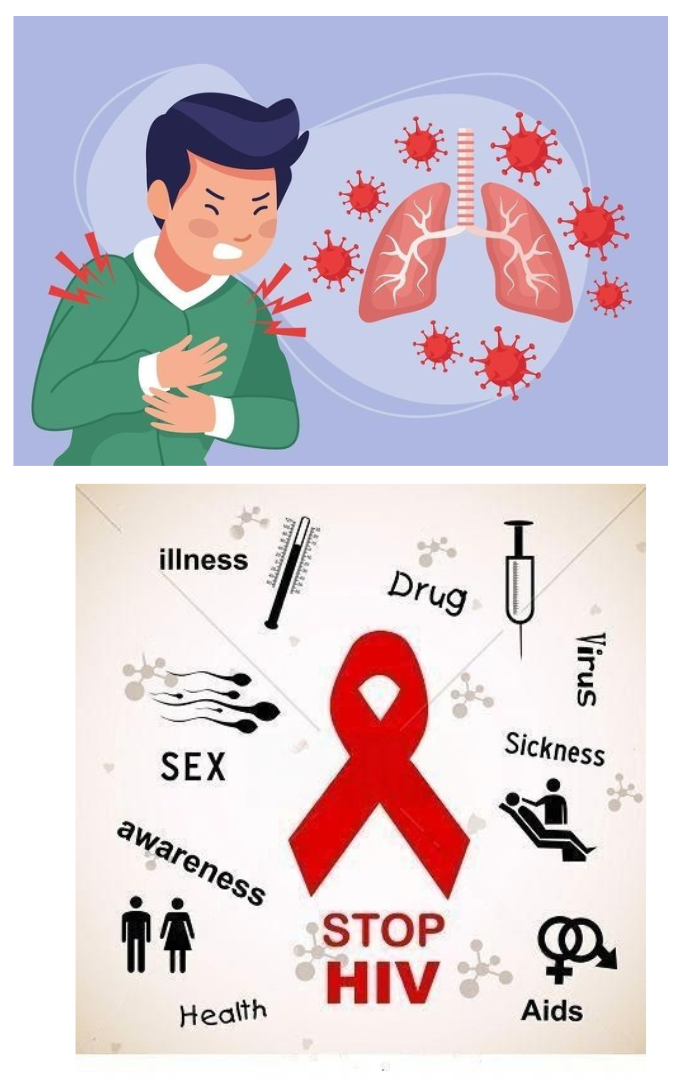 HIV