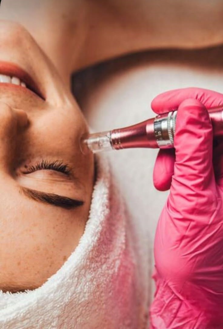 Microneedling